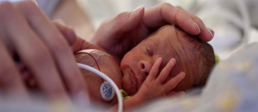 Billedet viser et neonatalt barn